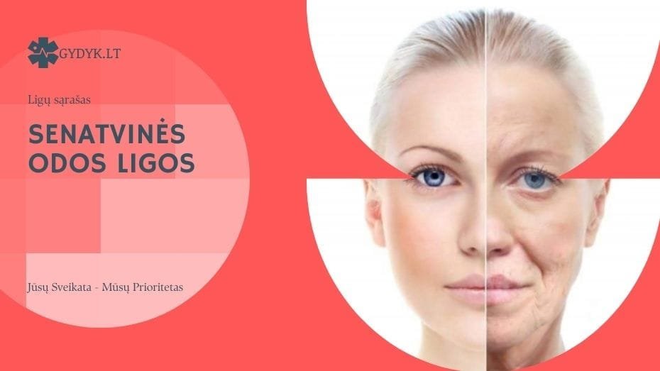 Senatvinės Odos Ligos: Sąrašas, Jų Simptomai ir Gydymas