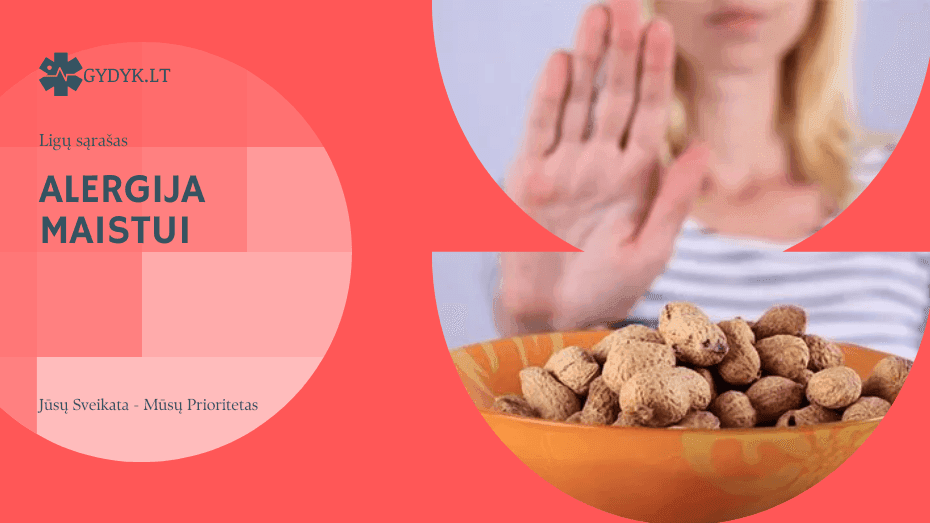 Alergija maistui: priežastys, simptomai ir gydymas