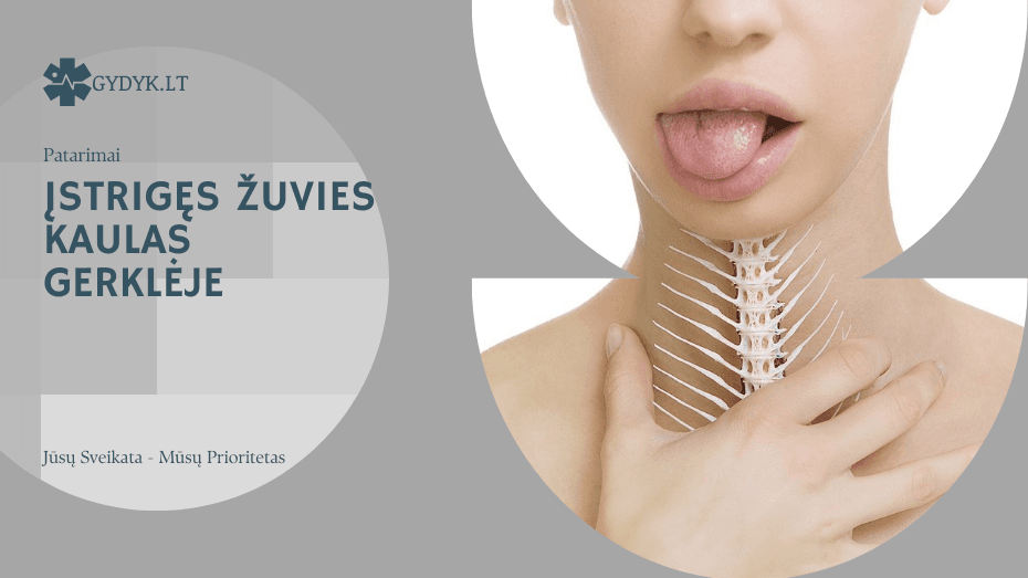 Įstrigęs žuvies kaulas gerklėje