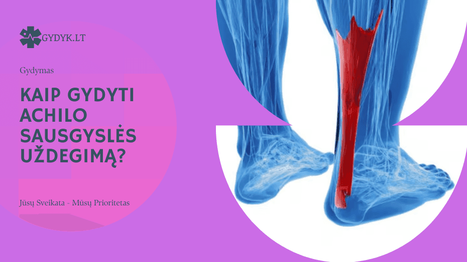 Kaip gydyti Achilo sausgyslės uždegimą?