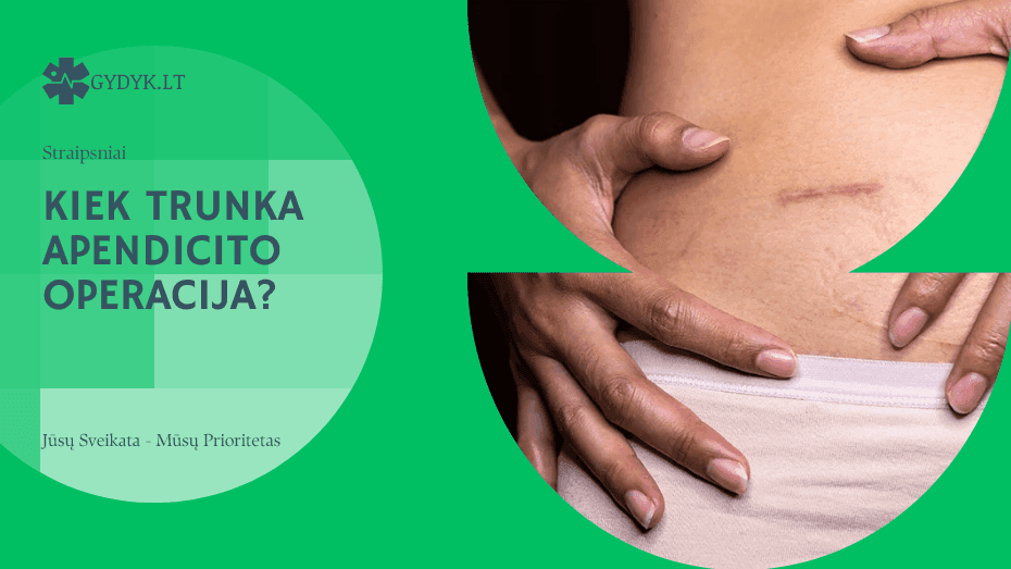 Kiek trunka apendicito operacija?