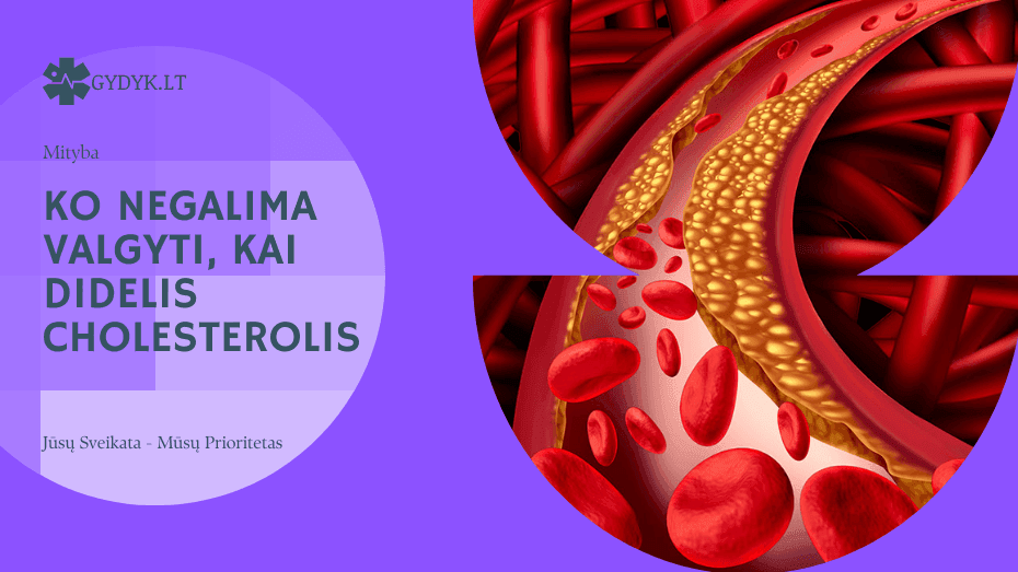 Ko negalima valgyti, kai didelis cholesterolis: pilnas sąrašas