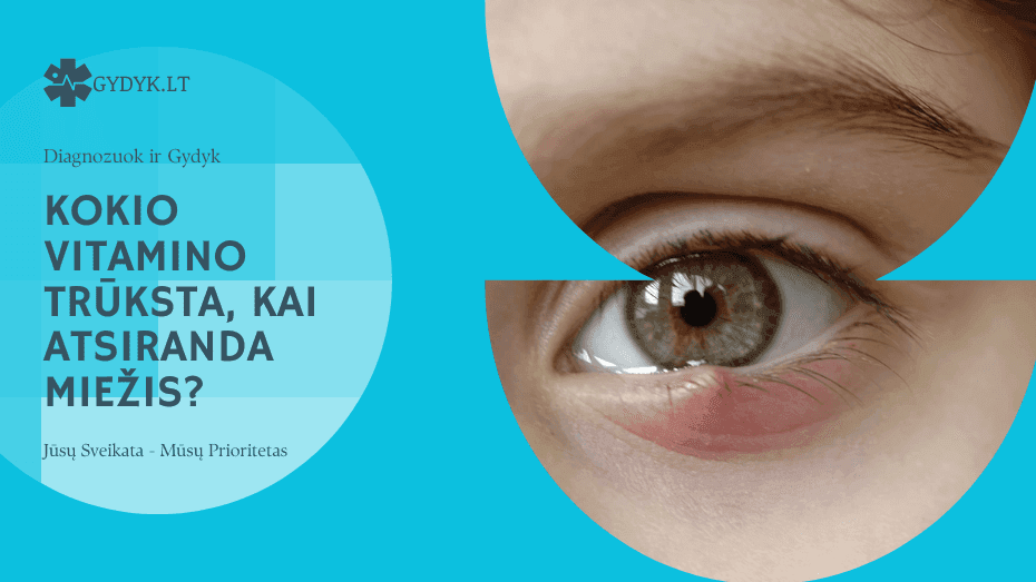 Kokio Vitamino Trūksta, Kai Atsiranda Miežis?