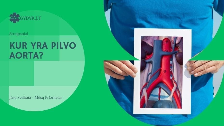 Kur yra pilvo aorta?