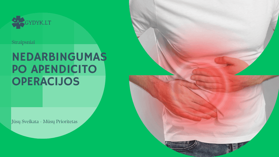 Nedarbingumas po apendicito operacijos: Kokiam laikui suteikiamas?