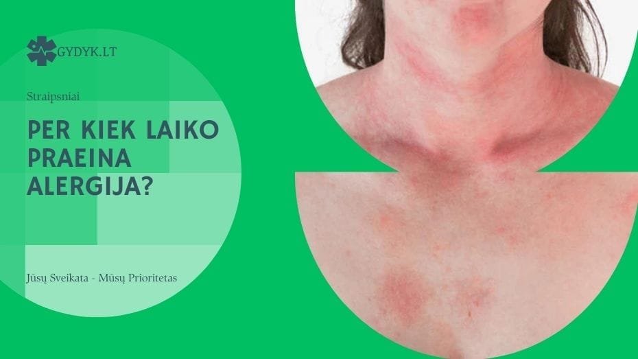 Per kiek laiko praeina alergija?