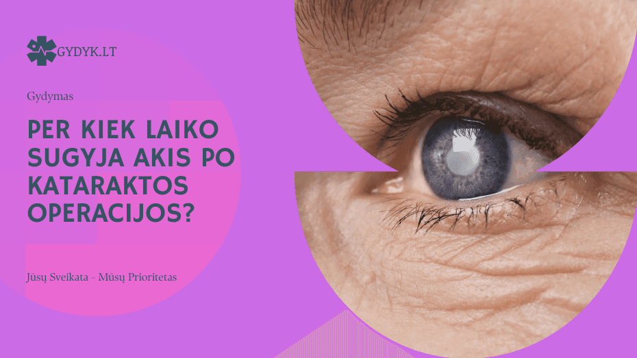 Per kiek laiko sugyja akis po kataraktos operacijos?
