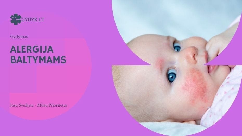 Alergija baltymams: bėrimo simptomai ir ką daryti
