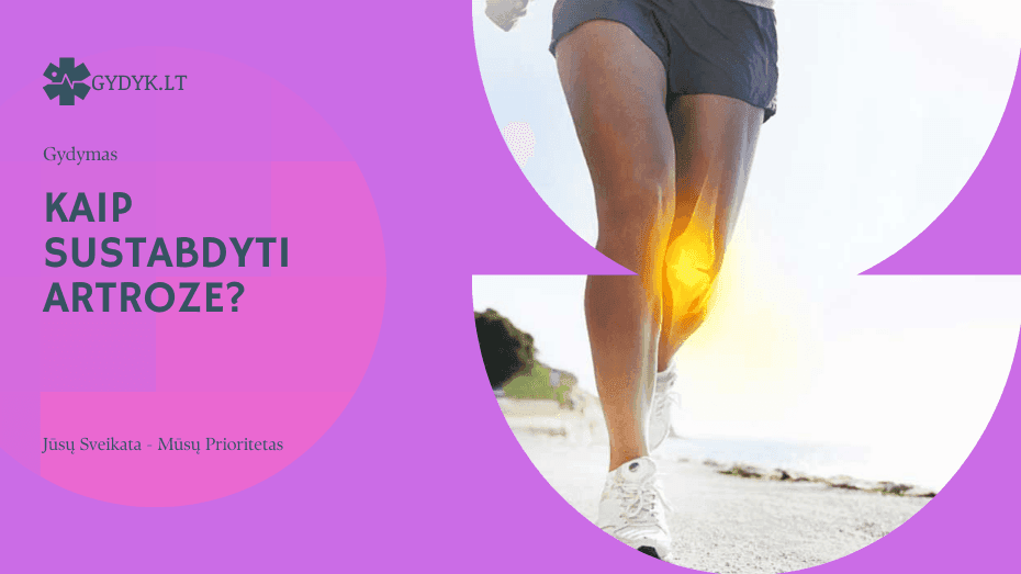 Kaip sustabdyti artrozę?