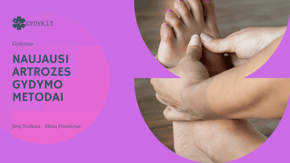 Naujausi artrozės gydymo metodai