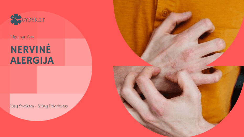Nervinė alergija: kas tai, priežastys, simptomai ir gydymas