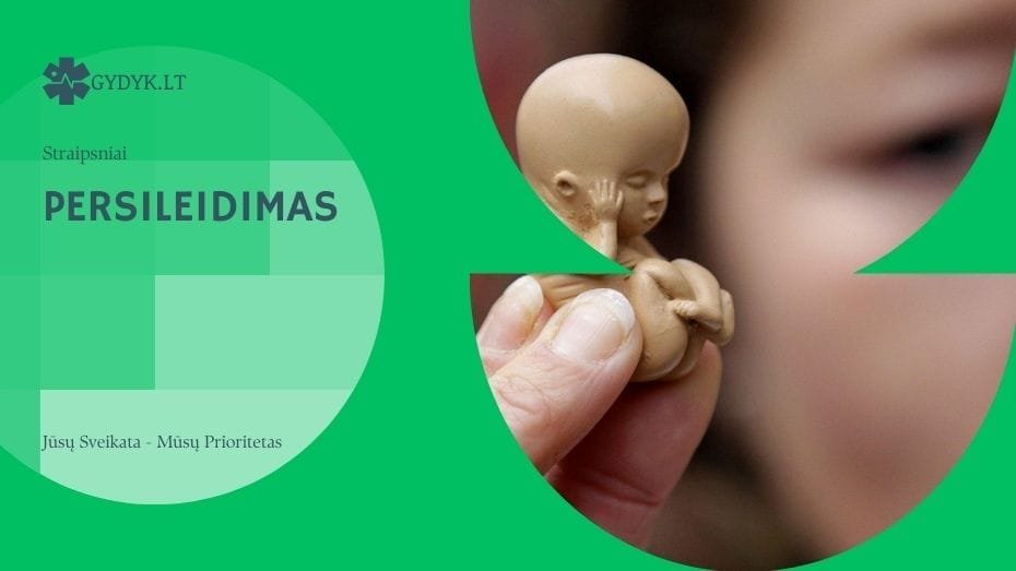 Persileidimas: Svarbi informacija ir atsakingas požiūris