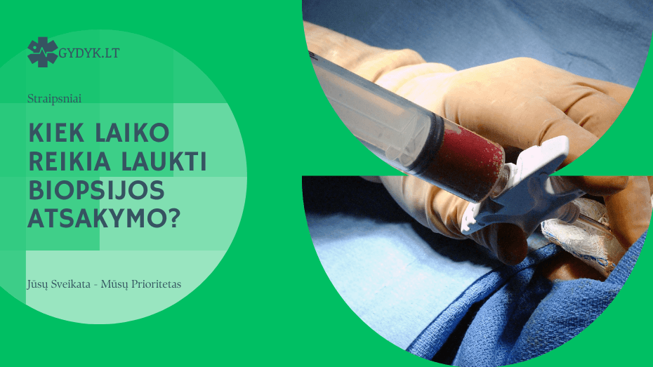 Kiek laiko reikia laukti biopsijos atsakymo