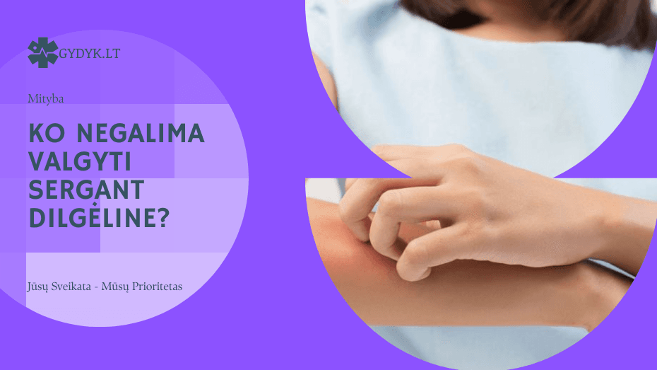 Ko negalima valgyti sergant dilgėline? Ko negalima valgyti sergant dilgėline