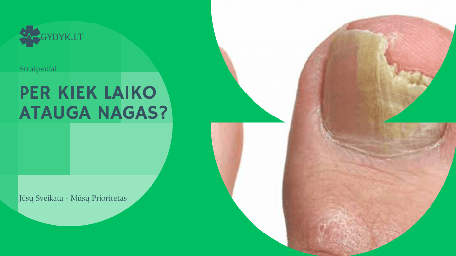 Per kiek laiko atauga nagas