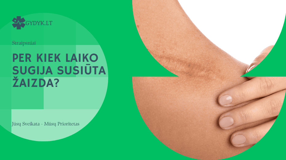 Per kiek laiko sugija susiūta žaizda