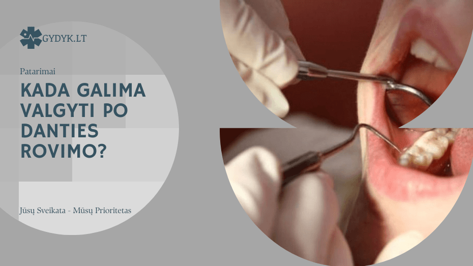 Kada galima valgyti po danties rovimo? Kada galima valgyti po danties rovimo