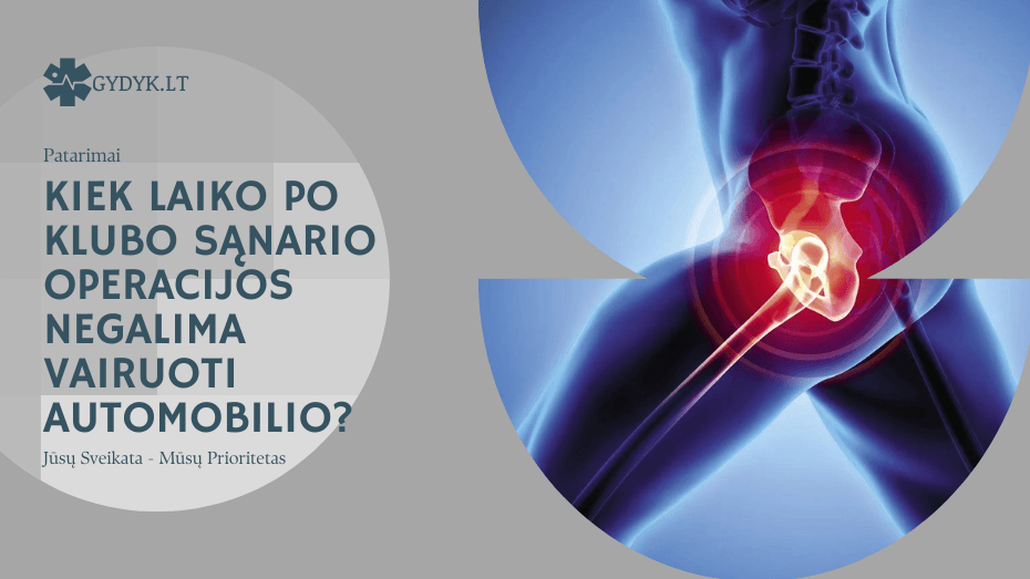 Kiek laiko po klubo sąnario operacijos negalima vairuoti automobilio? Kiek laiko po klubo sąnario operacijos negalima vairuoti automobilio