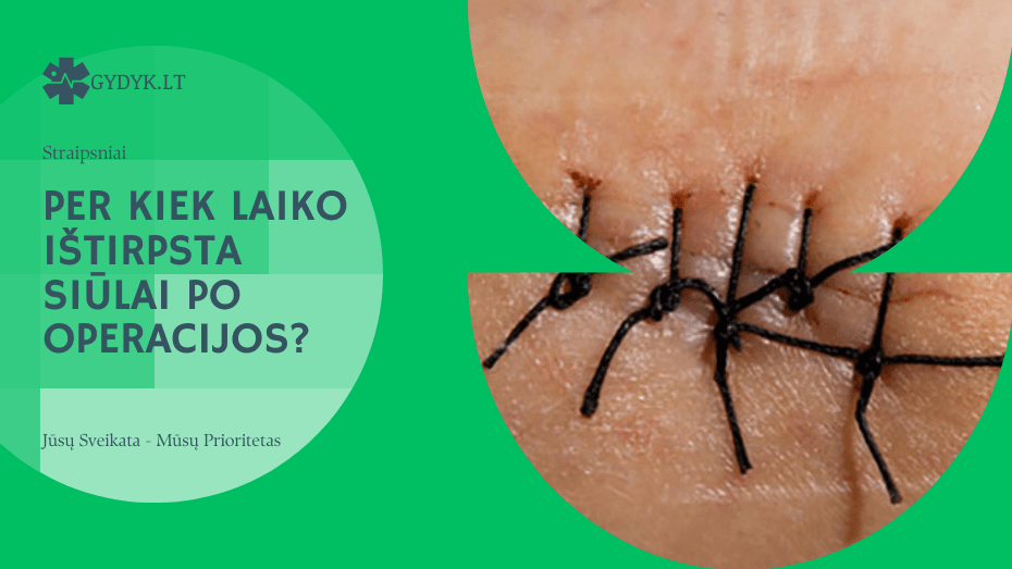 Per kiek laiko ištirpsta siūlai po operacijos