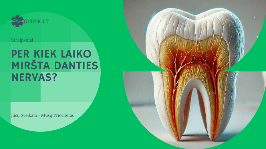 Per kiek laiko miršta danties nervas? Per kiek laiko miršta danties nervas