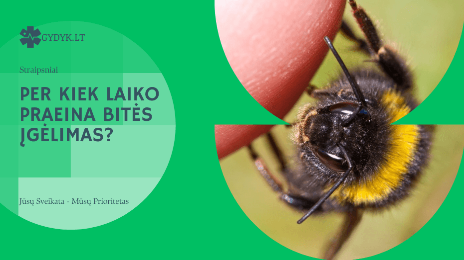 Per kiek laiko praeina bitės įgėlimas? Per kiek laiko praeina bitės įgėlimas