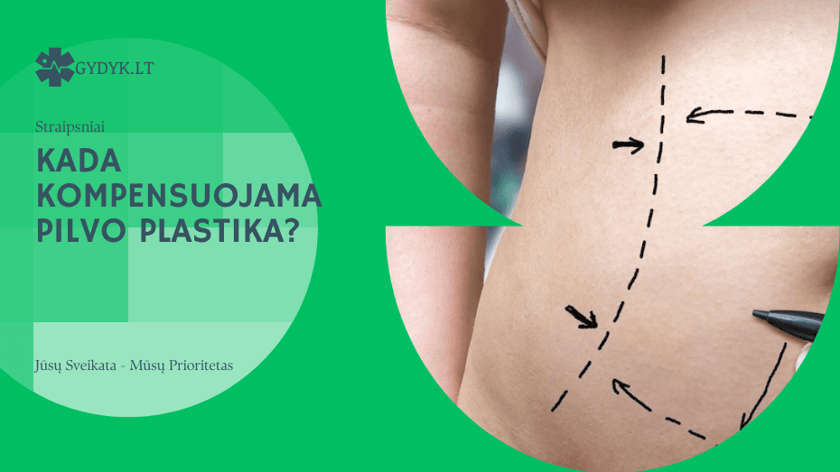 Kada kompensuojama pilvo plastika? Kada kompensuojama pilvo plastika