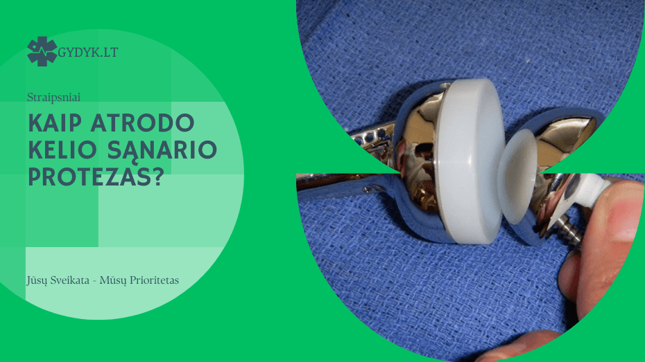 Kaip atrodo kelio sąnario protezas