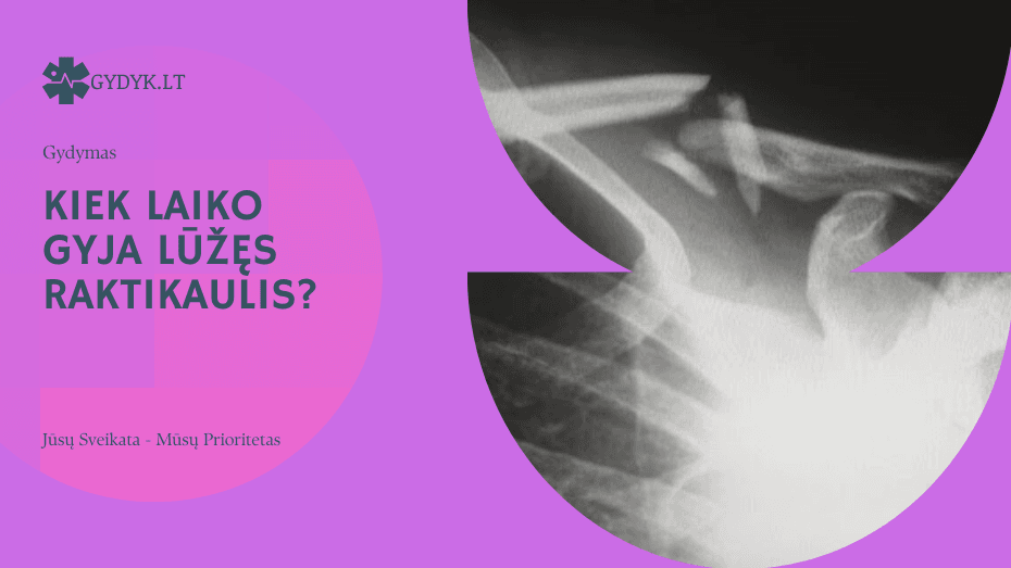 Kiek laiko gyja lūžęs raktikaulis? Kiek laiko gyja lūžęs raktikaulis