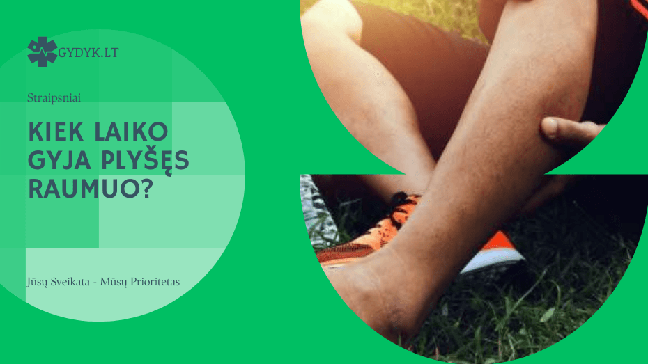 Kiek laiko gyja plyšęs raumuo