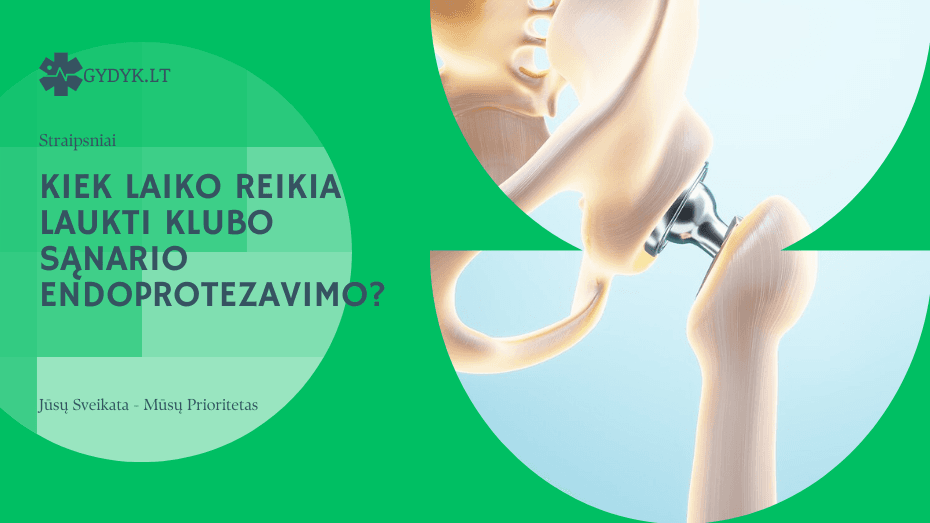 Kiek laiko reikia laukti klubo sąnario endoprotezavimo