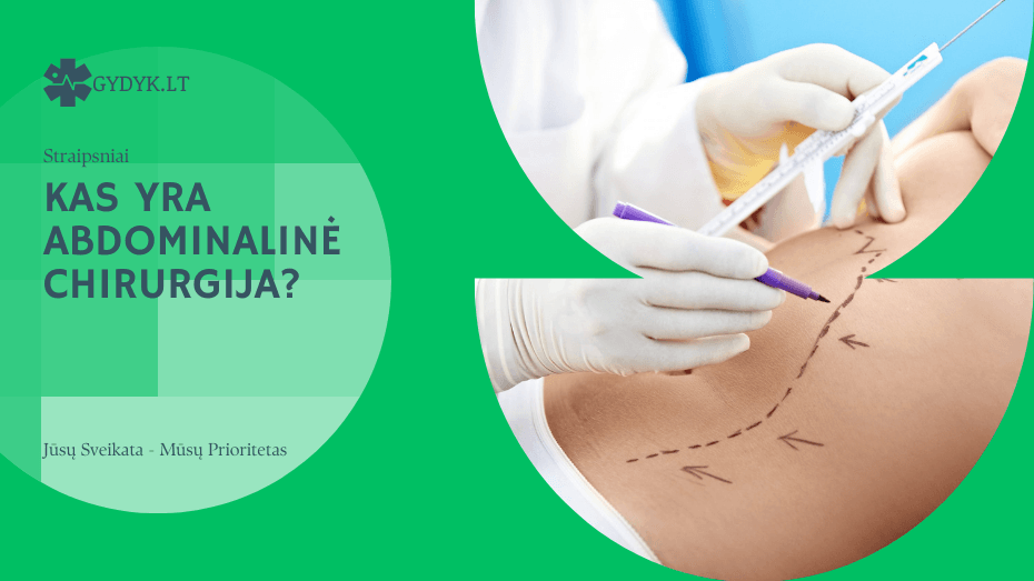 kas yra abdominalinė chirurgija
