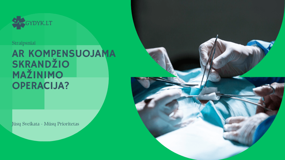 Ar kompensuojama skrandžio mažinimo operacija