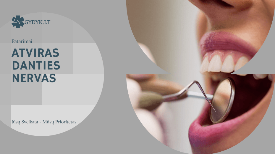 Atviras danties nervas: kaip numalšinti skausmą? Atviras danties nervas