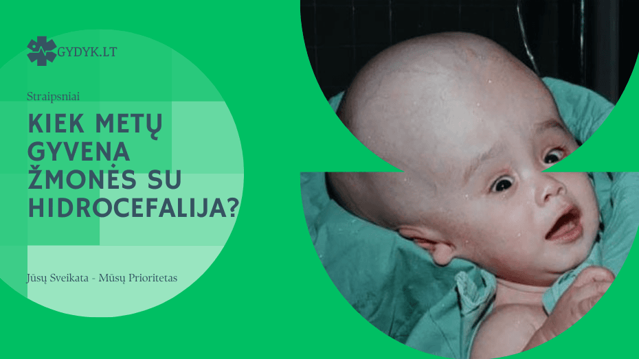 Kiek metų gyvena žmonės su hidrocefalija? Kiek metų gyvena žmonės su hidrocefalija