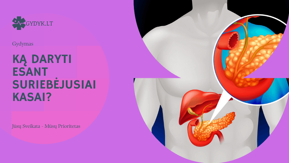 Suriebėjusi kasa – ką daryti? ką daryti esant suriebėjusiai kasai