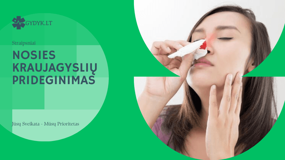 Nosies kraujagyslių prideginimas