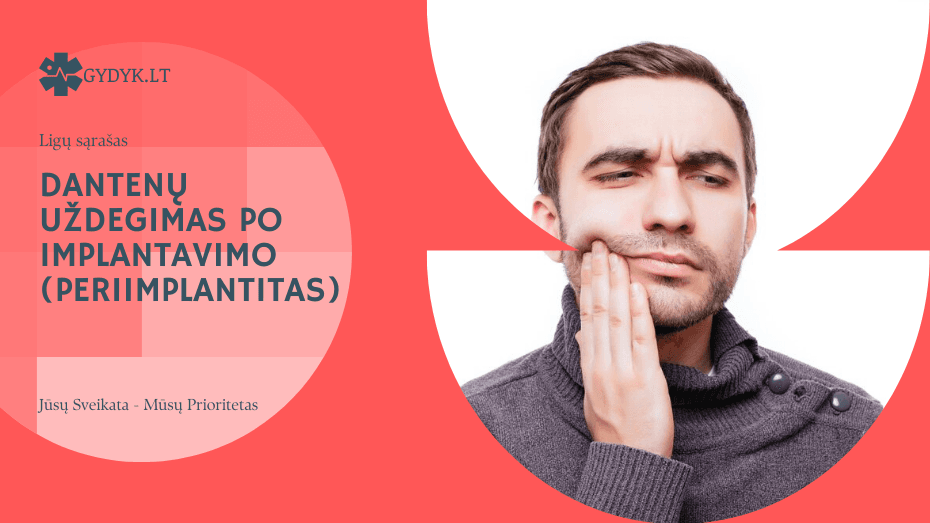 Dantenų uždegimas po implantavimo (Periimplantitas)