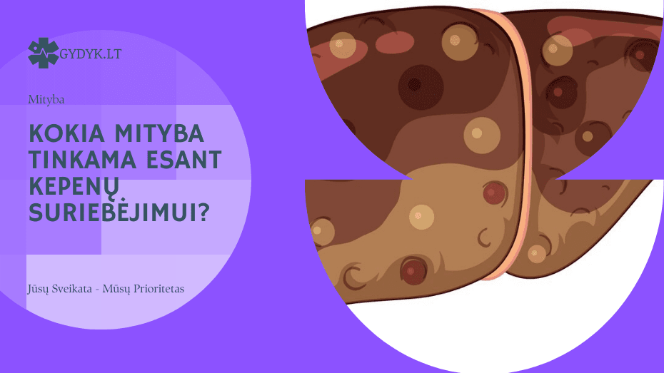 Kepenų suriebėjimas – kokia mityba ir dieta privaloma? kokia mityba tinkama esant kepenų suriebėjimui