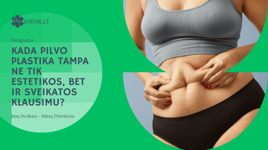 Kada pilvo plastika tampa ne tik estetikos, bet ir sveikatos klausimu