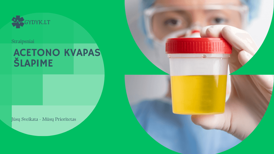 Acetono kvapas šlapime