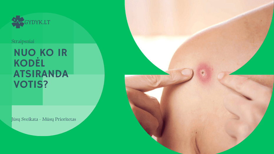 Nuo ko ir kodėl atsiranda votis