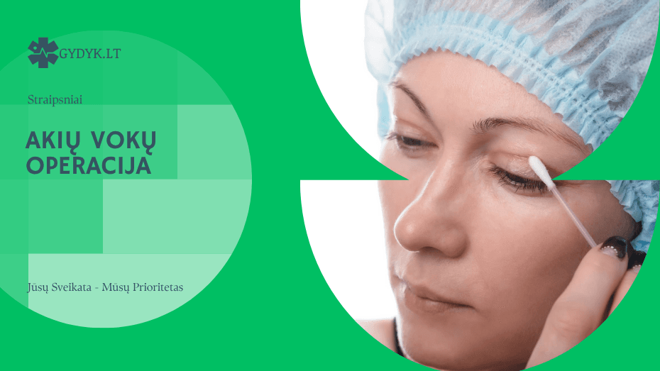 Akių vokų operacija