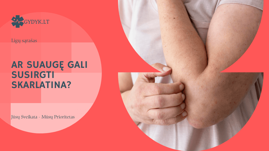 Ar suaugę gali susirgti skarlatina Gydytojų paaiškinimas