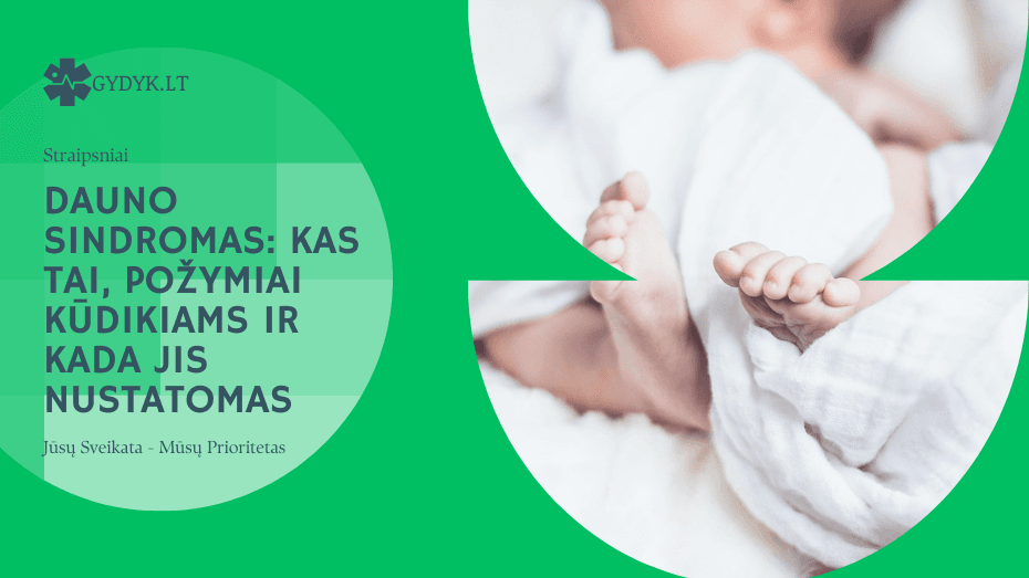 Dauno sindromas kas tai, požymiai kūdikiams ir kada jis nustatomas