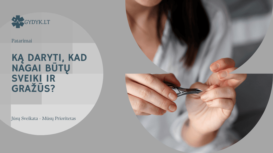 Ką daryti, kad nagai būtų sveiki ir gražūs