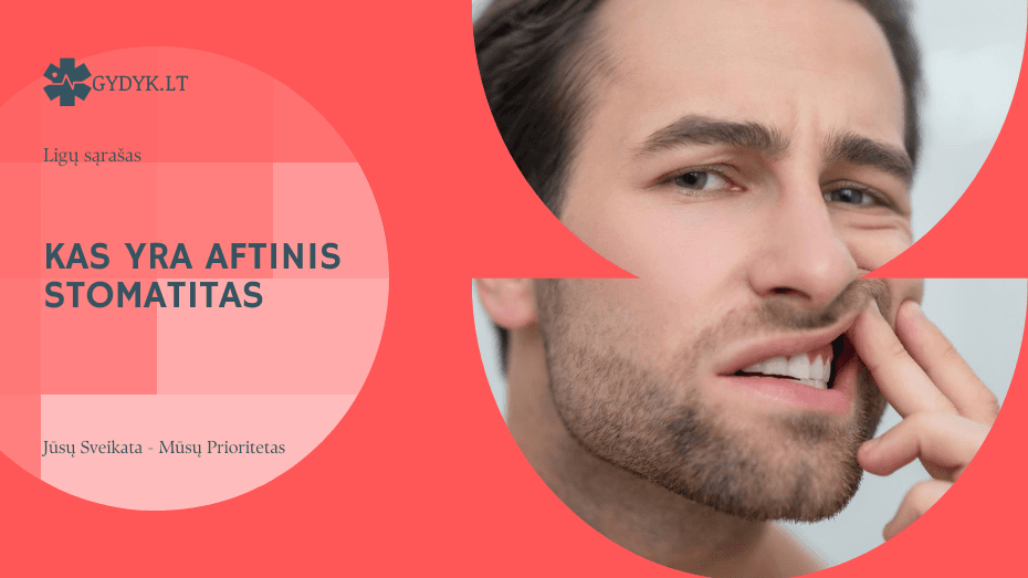 Kas yra aftinis stomatitas