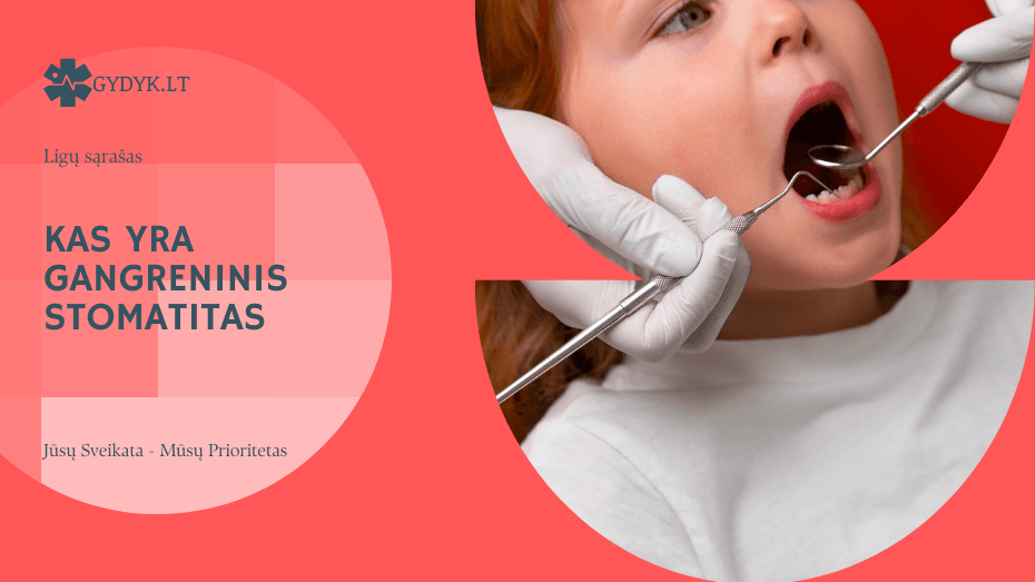 Kas yra gangreninis stomatitas