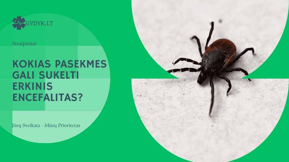 Kokias pasekmes gali sukelti erkinis encefalitas