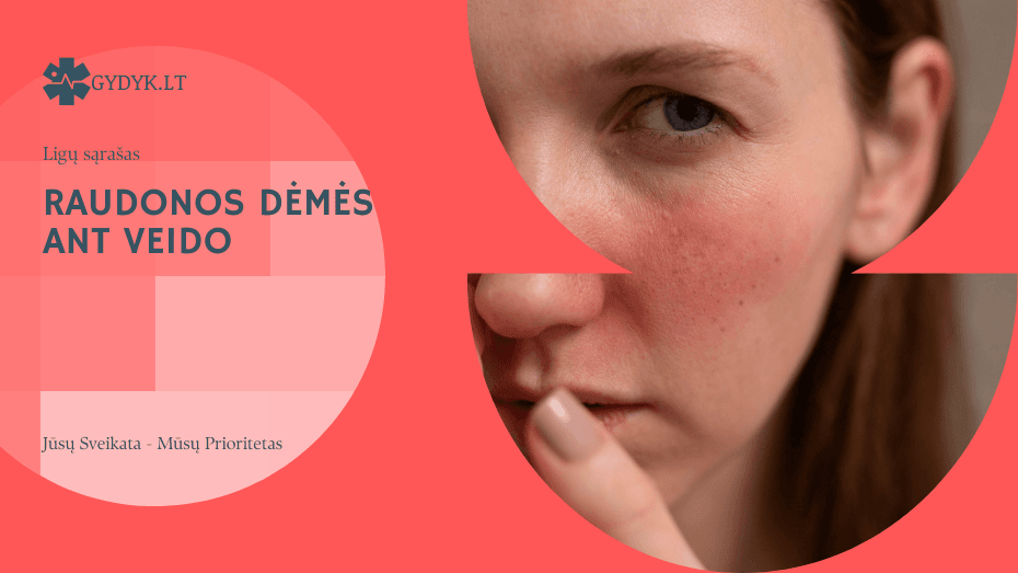 Raudonos dėmės ant veido: galimos priežastys ir kaip jas gydyti Raudonos dėmės ant veido(1)