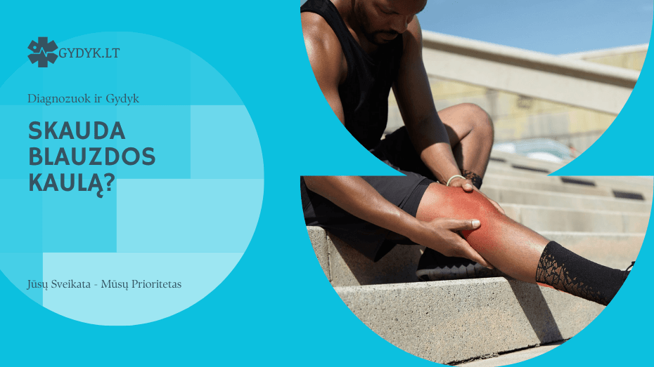 Skauda blauzdos kaulą